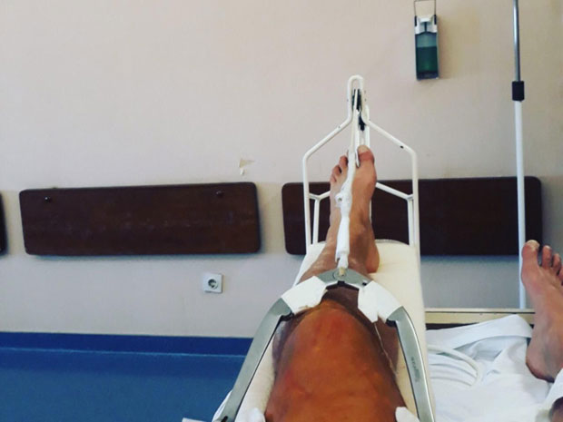 Ђуричић се огласио након саобраћајне незгоде, погледајте његове прве фотографије из болнице! (ФОТО)