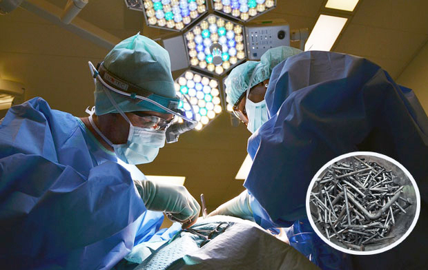 Прогутао 116 ексера, па завршио у болници