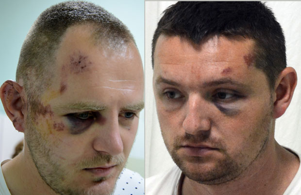 СУД У СЕВЕРНОЈ МИТРОВИЦИ ОДЛУЧИО: Ухапшени Срби пуштени да се бране са слободе; Повређени превезени у КБЦ (ФОТО)