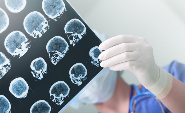 Отворили јој главу да одстране тумор, а открили неочекиваног госта (ФОТО)
