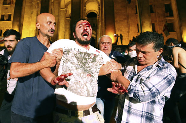 КРВ У ТБИЛИСИЈУ ЗБОГ РУСА: У масовним демонстрацијама повређене стотине