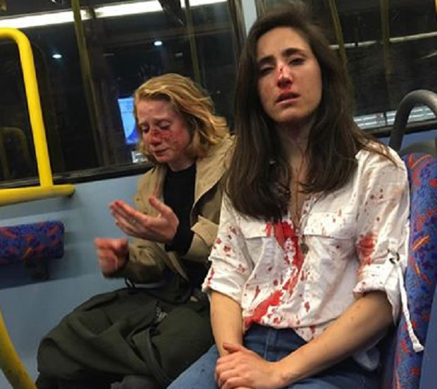 ЗЛОЧИН ИЗ МРЖЊЕ: Напали две девојке које нису хтеле да се љубе