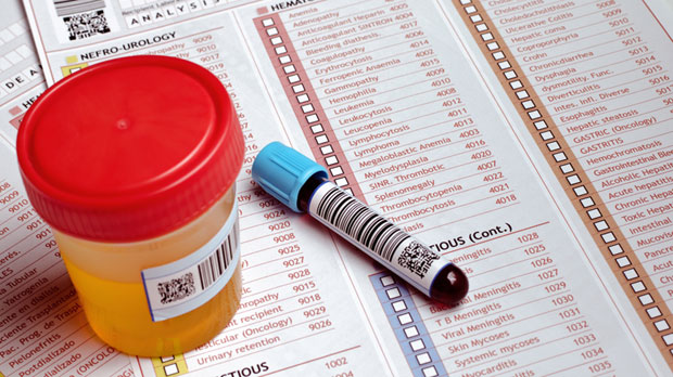 Лекар подметнуо своју крв и урин да спаси пијаног брата