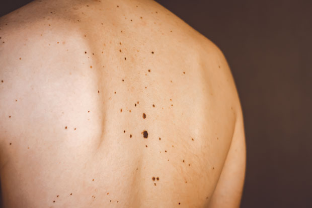 Крупни младежи успоравају старење