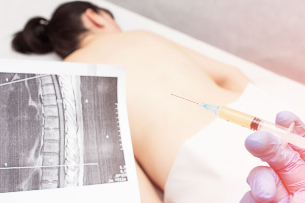 Бол у леђима лече иглом и кисеоником
