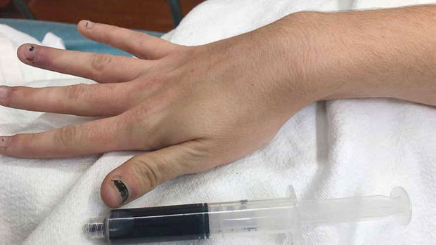 Жена буквално плаве крви шокирала лекаре, то су виђали само у књигама