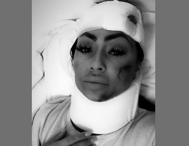 ЗВЕЗДА ГРАНДА ЗАВРШИЛА У ХИТНОЈ ПОМОЋИ: Oливера на ортопедији