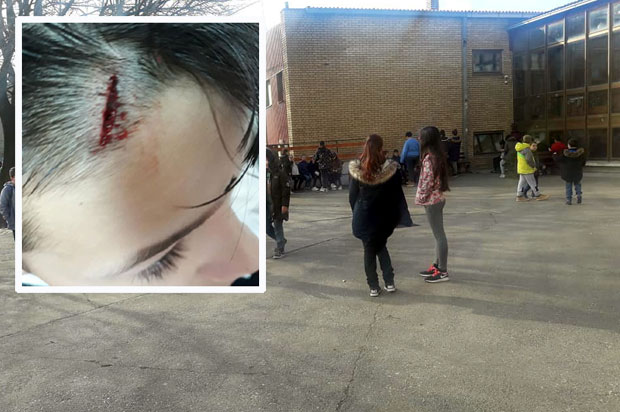 Дечаку са срчаним проблемима, расекли главу о сто за време часа?! Родитељи најављују тужбу (УЗНЕМИРУЈУЋЕ ФОТОГРАФИЈЕ) 