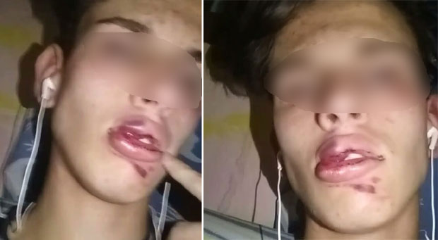 Тетка претученог младића: Зар би требало да чекамо да нечија мајка закука? 