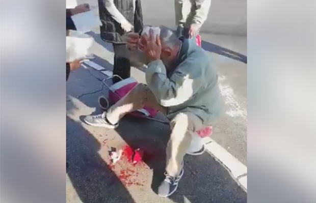 ЈЕЗИВО: Мушкарац главом одвалио знак на аутобуској станици!