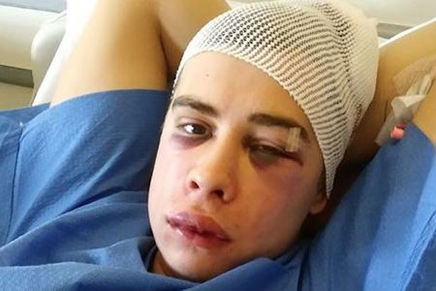 Јурица (23) је брутално претучен на концерту Прљавог казалишта, а сад је откривено и зашто: Прећутао је грозну ствар коју је урадио пре батина