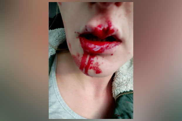 Огласила се полиција после пребијања самохране мајке: Радили смо по закону