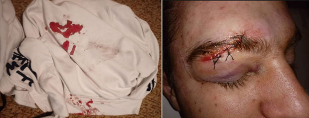 Седморица ми тукла дете: Суботичанка очајна после напада на њеног сина 