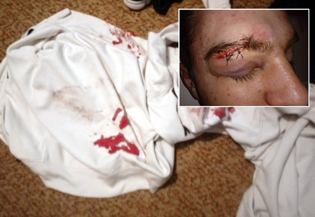 Малолетница је сведочила пребијању у Суботици, а сада и њој прете смрћу