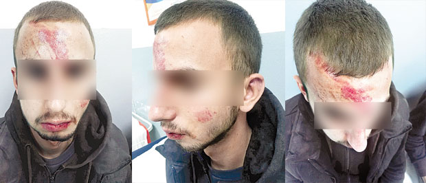 Војни пензионер излетео из црног „аудија“ и крвнички претукао Марка: Дечаку извлачили језик да се не угуши