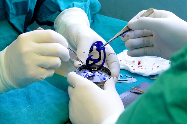 Нова нада за рођене без ушне шкољке