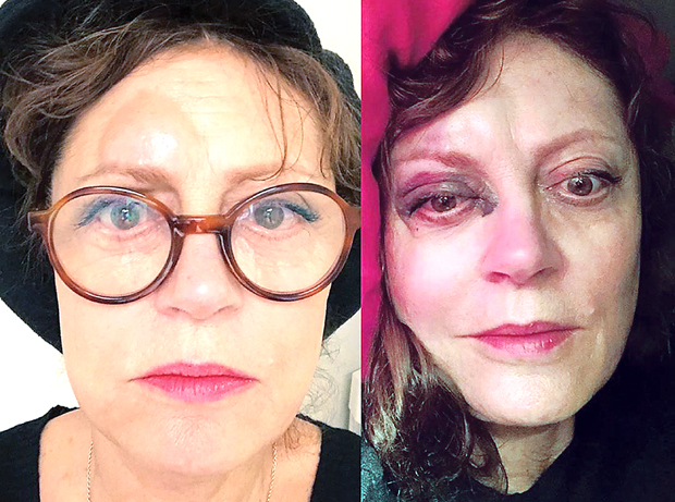 Сузан Сарандон сломила нос