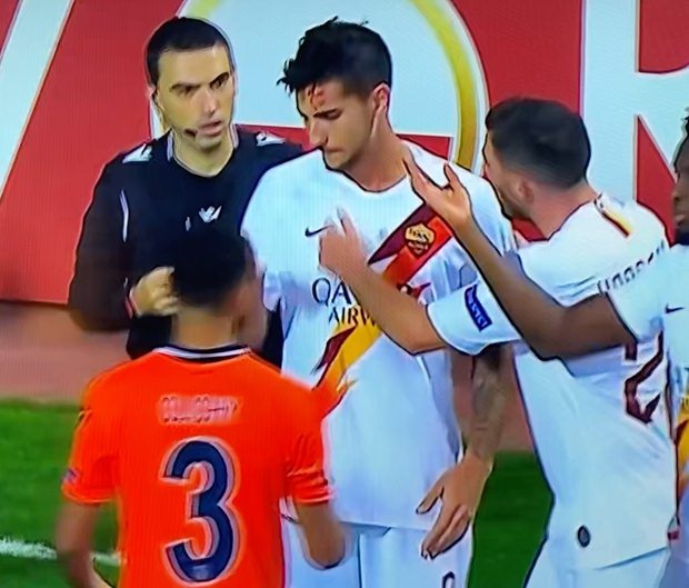 Навијачи Бешахшехира поцепали Пелегринију главу (ФОТО/ВИДЕО)