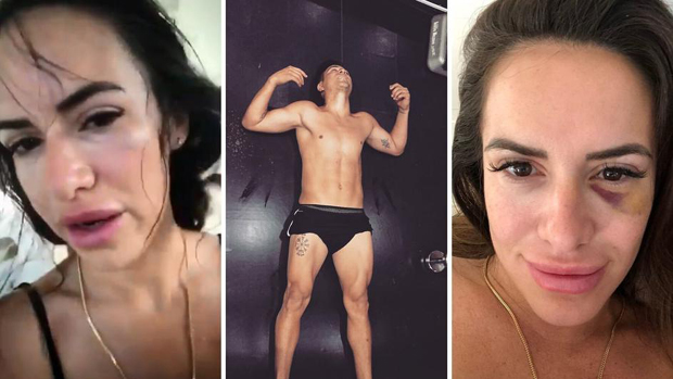 Бивши репрезентативац Аргентине претукао девојку: Ударао ме и вукао по поду, дозивала сам помоћ 