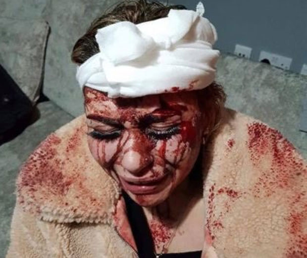 Глава јој обливена крвљу: Жена нападнута стакленом флашом насред улице 