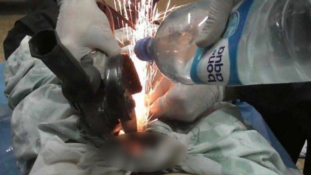 Кобре брусилицом ослобађале полни орган неверног мужа: Прича која је шокирала цео свет