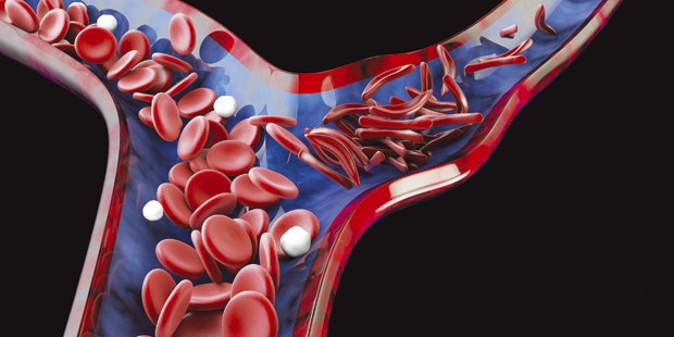 Ако вас обузме необјашњив умор проверите крвну слику: Овај минерал морате надокнадити ако га нема довољно