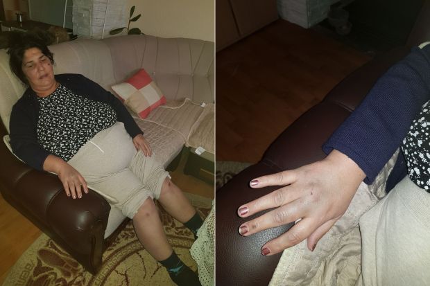 Жаклина (51) ИСПАЛА ИЗ АУТОБУСА у покрету: Жена ишла код лекара, а онда су се изненада отворила врата