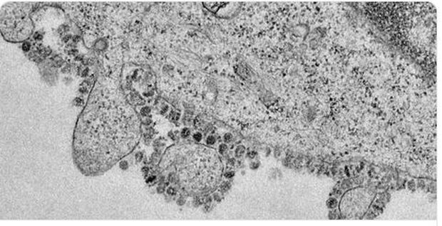 Објављен снимак РАЗМНОЖАВАЊА корона вируса: Свака инфицирана ћелија може да произведе хиљаде нових вирусних честица (ВИДЕО) 