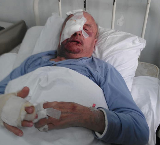 Тројица разбојника пробудила су Миодрага ШАМАРИМА и УДАРЦИМА, а онда је уследило зверско мучење: Претукли су старца због - 10.000 динара и 50 евра