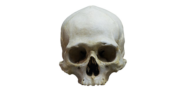 Разјашњен део мистерије: На грани шљиве у Мрчићима била лобања жене