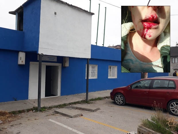 Мухамед је Јелени ПОЛОМИО зубе и вилицу: За брутално пребијање је добио ДВЕ ГОДИНЕ