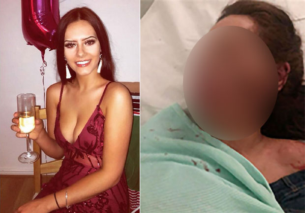 Чекала је испред клуба, а онда је уследио напад: 23-годишњакиња завршила са тешким повредама - ни крива ни дужна (ФОТО/ВИДЕО)