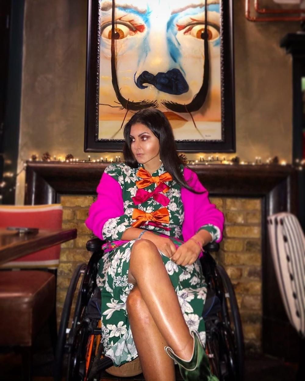 Манекенка се пробудила са утрнулом руком: Соњи су рекли да је то од анксиозности, али истина је била језива