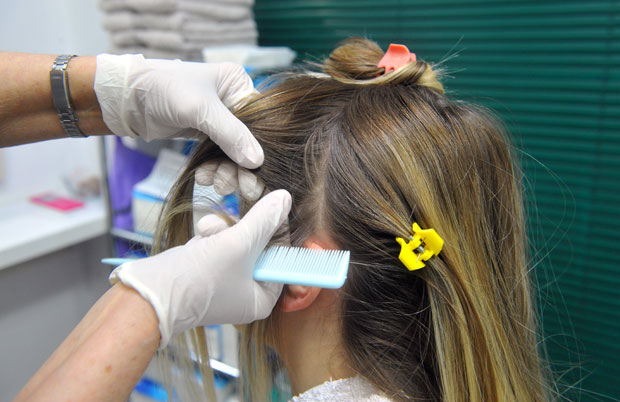 Нема их у фарбаној или блајханој коси, а довољно је опрати са специјалним шампоном: Које су заблуде везане за вашке и како их се решити?