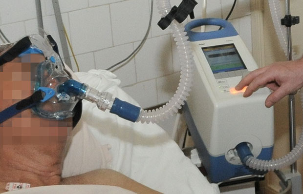 Расписан хитан тендер: Србија набавља 15 респиратора за резерву