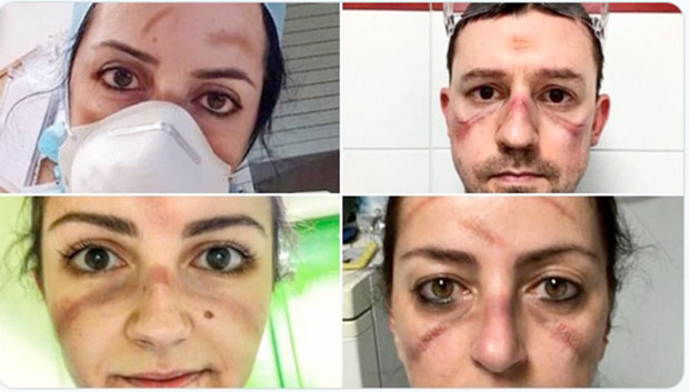 Свет не памти овакве мученике и хероје: Погледајте лица италијанских медицинара (ФОТО+ВИДЕО)