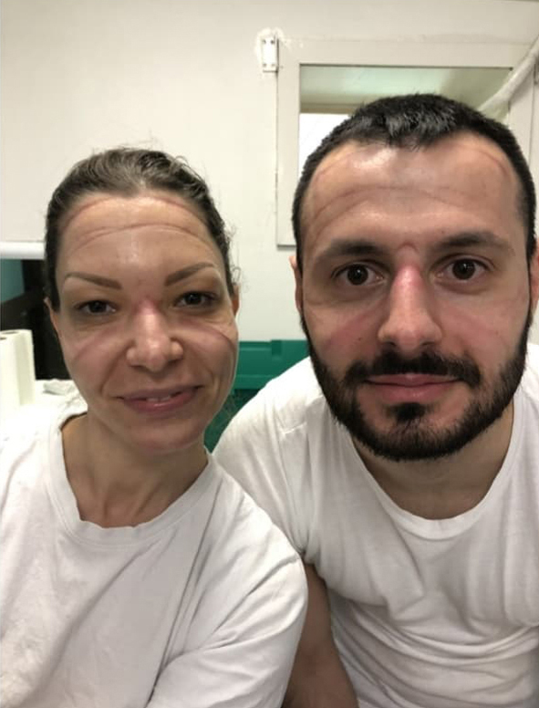 „Боли када после четири сата скидаш маску. Још болније је када је опет стављамо, али издржаћемо“: Нишки анестезиолози брину о најтежим пацијентима оболелим од вируса корона