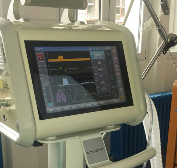 Митрополија донирала респираторе Клиничком центру Црне Горе (ФОТО)