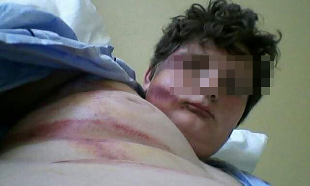 Упозорио их је да не секу стабла, а они узвратили батинама: Шумокрадице претукле малолетника код Брчког