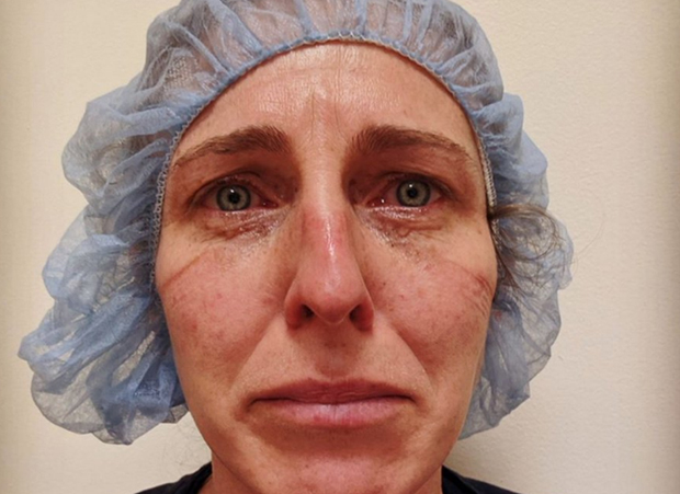 “Три ноћи сам се борила за њега, на крају се предао, у соби смо били само он и ја”: Исповест сестре којој је пацијент умро на рукама