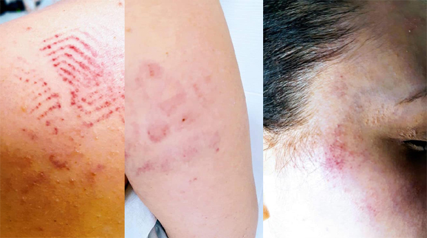 Затражила да јој се врати дуг, а уместо новца Анђелка (25) добила батине: Кривична пријава против три девојке из Пирота (FOTO)