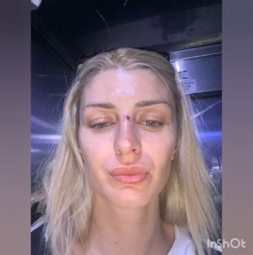 Питала је Шта радиш то, љубави?. Уследила је ШАМАРЧИНА: Сандра Обрадовић је показала први пут језив снимак (ВИДЕО)