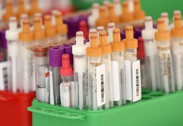 Тест на корона вирус кошта 8.225 ДИНАРА: Цена обухвата узорковање, тестирање и сертификат, а ово су УСЛОВИ које морате испунити