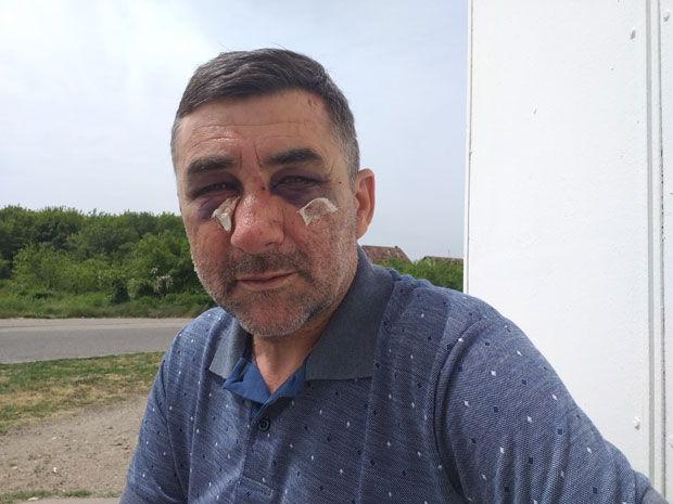 Ударали су ме и ШУТИРАЛИ У ГЛАВУ И БУБРЕГЕ, викао сам “Доста више”, али се НИСУ ЗАУСТАВЉАЛИ: Возач цистерне ЗАВРШИО У БОЛНИЦИ, претукли га јер их је питао што су му гађали шоферку?