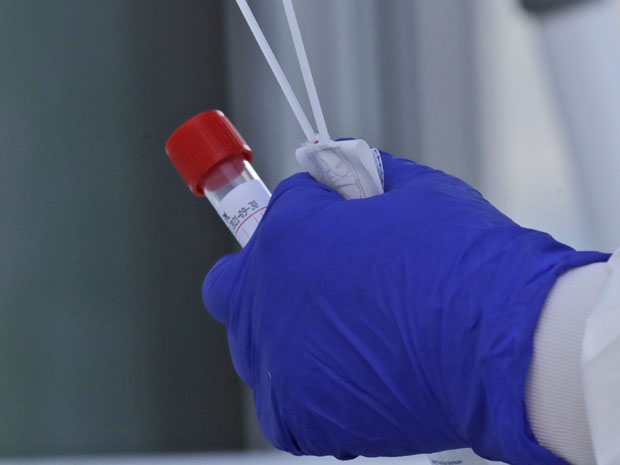 ПОЧЕЛО ЕЛИСА ТЕСТИРАЊЕ: У Србији од 1. јуна можете да се тестирате на корона вирус, а ево колика је цена