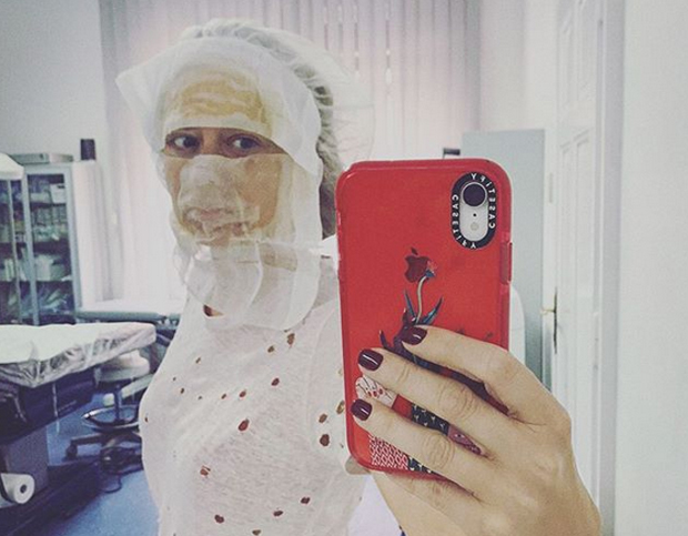 Јелена Вељача била на третману подмлађивања крвном плазмом: Овако изгледа после улепшавања, а ово је хтела да скине са лица