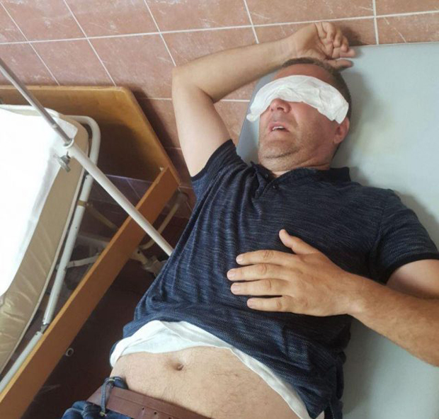 Дивљачко иживљавање припадника САЈ-а над функционерима Општине Будва: Бившег председника ПРЕБИЛИ и БАЦИЛИ НИЗ СТЕПЕНИЦЕ! (ФОТО)