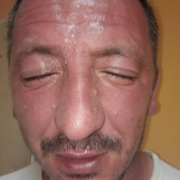 Бруталност црногорске полиције: Сузавац, бибер спреј и шок бомбе на грађане, Никшићанин умало остао без вида (ФОТО)