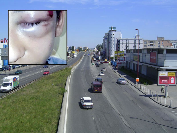 Физичке ране пролазе, боље му је иако не види као пре, али је страх јачи: Габријел (14), брутално претучен у полицијској акцији у Паризу, спас тражи у сну између четири зида (ФОТО)