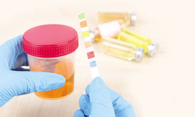 На шта указује боја урина?